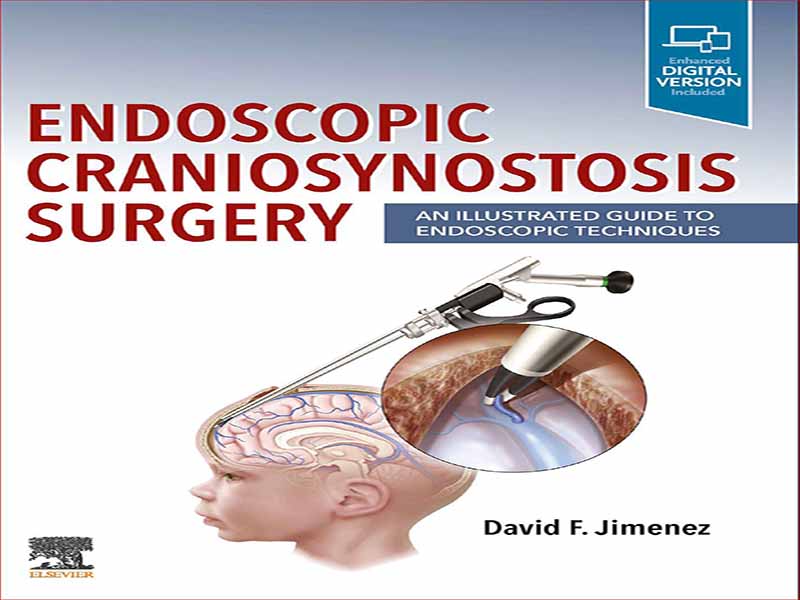 دانلود کتاب جراحی آندوسکوپی کرانیوسینوستوز – راهنمای مصور تکنیک های آندوسکوپی