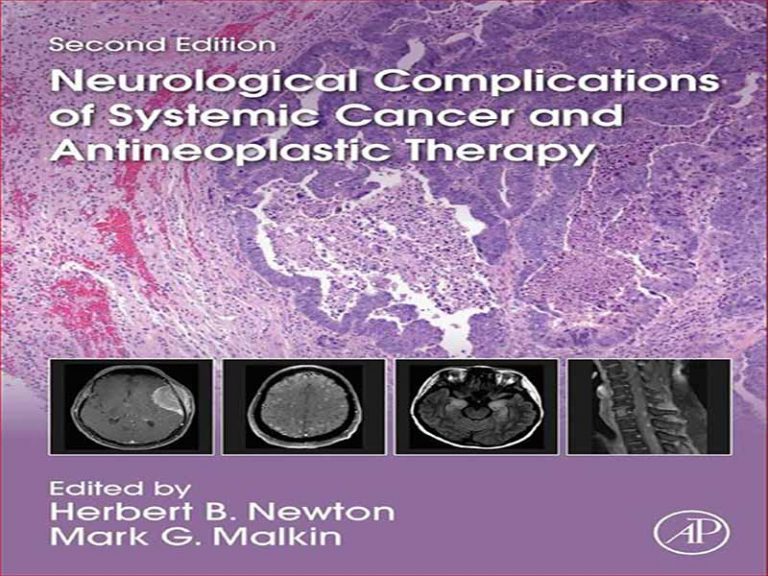 دانلود کتاب عوارض عصبی سرطان سیستمیک و درمان ضد نئوپلاستیک