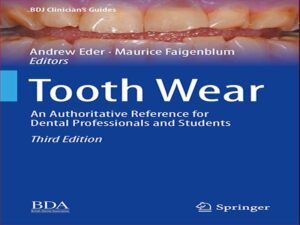 دانلود کتاب سایش دندان – مرجع معتبر برای متخصصان و دانشجویان دندانپزشکی