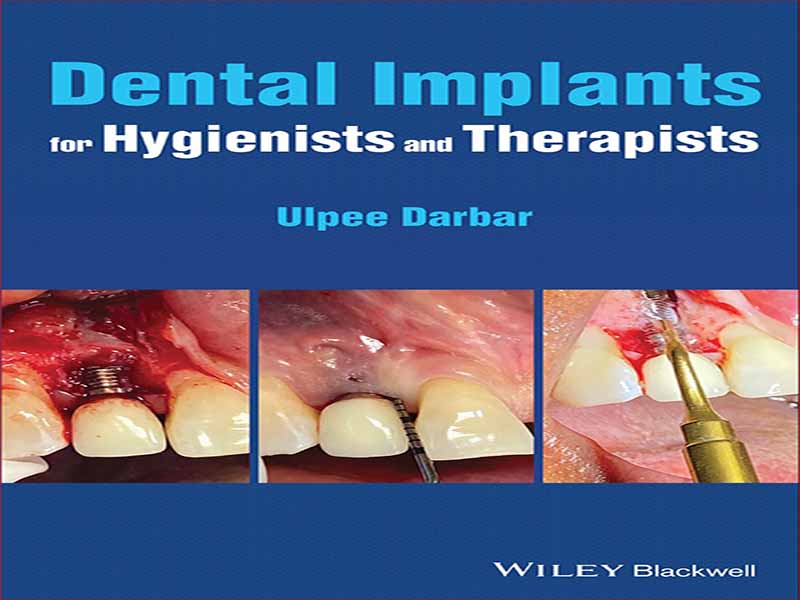 دانلود کتاب ایمپلنت دندان برای متخصصین بهداشت و درمانگر