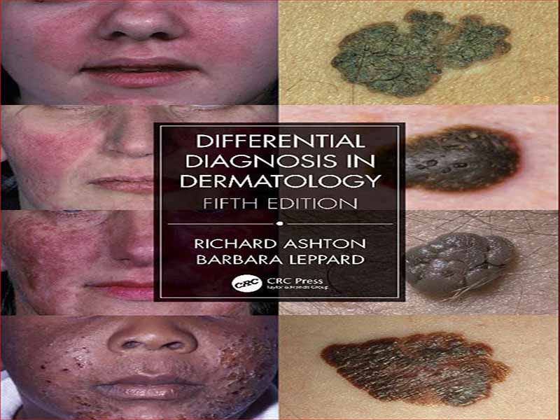 دانلود کتاب تشخیص افتراقی در پوست