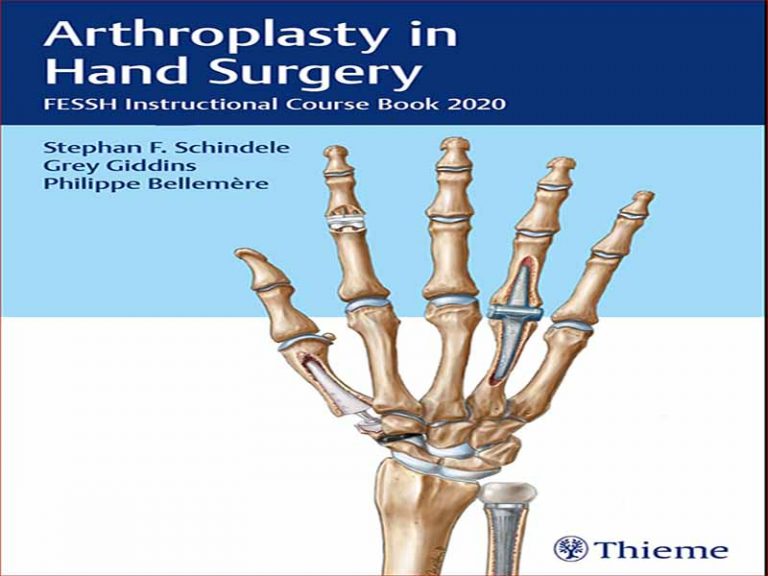 دانلود کتاب آرتروپلاستی در جراحی دست