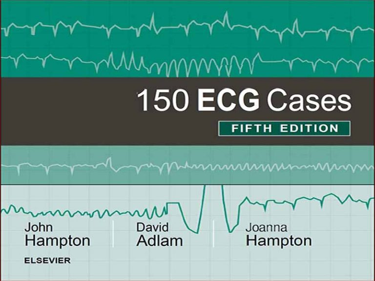 دانلود کتاب 150 مورد ECG (نوار قلب) | تفسیر نوار قلب