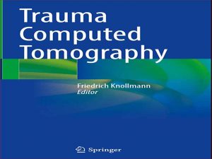 دانلود کتاب توموگرافی کامپیوتری تروما